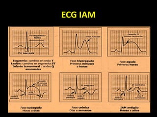 ECG IAM
 