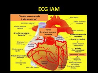 ECG IAM
(Descendente Anterior)
Tronco
De arteria coronaria
izquierda
Circulacion coronaria
( Vista anterior)
 