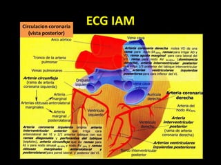 ECG IAMCirculacion coronaria
(vista posterior)
 