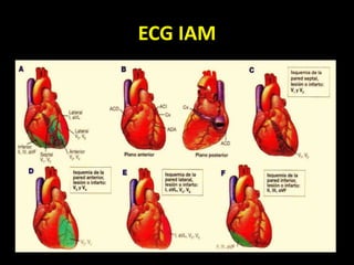 ECG IAM
 