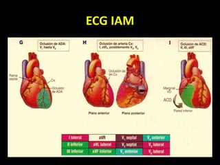ECG IAM
 