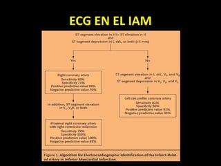 ECG EN EL IAM
 