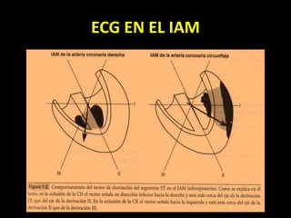 ECG EN EL IAM
 