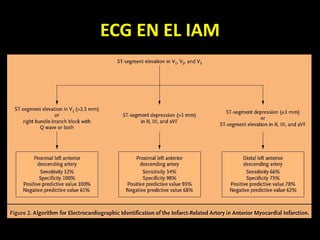 ECG EN EL IAM
 