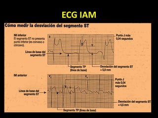 ECG IAM
 