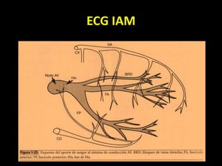 ECG IAM
 