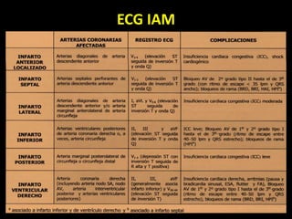 ECG IAM
 