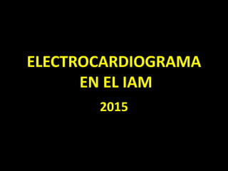 ELECTROCARDIOGRAMA
EN EL IAM
2015
 