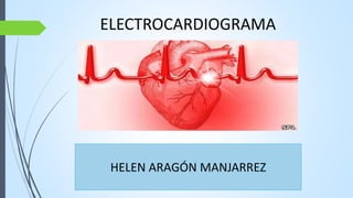 ELECTROCARDIOGRAMA
HELEN ARAGÓN MANJARREZ
 