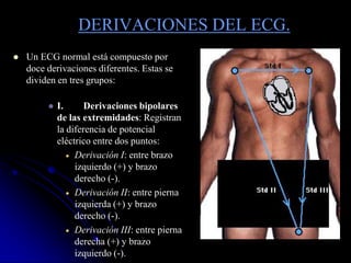 DERIVACIONES DEL ECG.Un ECG normal está compuesto por doce derivaciones diferentes. Estas se dividen en tres grupos:I.	Derivaciones bipolares de las extremidades: Registran la diferencia de potencial eléctrico entre dos puntos: Derivación I: entre brazo izquierdo (+) y brazo derecho (-). 