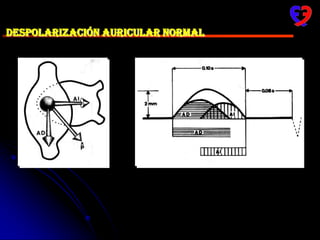¿Qué hace el ECG?El ECG capta, desde la superficie del cuerpo mediante electrodos, la activación eléctrica de los ventrículos y las aurículas. 