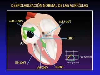 Despolarización Auricular Normal
