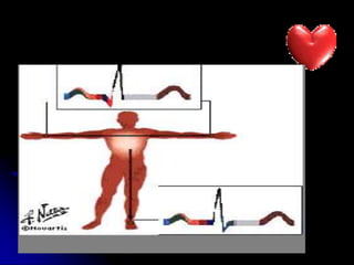 DESPOLARIZACION VENTRICULAR