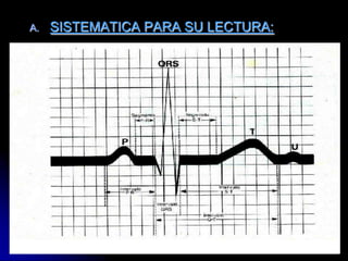 SISTEMATICA PARA SU LECTURA:	Anotar: Nombre, edad del paciente, fecha y hora del registro.	Efectuar una rápida observación en todo el trazado y así tener una idea del mismo.	Posteriormente, deberá realizarse una lectura minuciosa y ordenada como se indica.