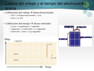 Calibre del voltaje y el tiempo del electrocardio
grama
 