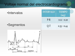 Voltaje normal del electrocardiograma
•Intervalos
•Segmentos
 