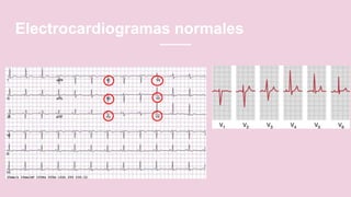 Electrocardiograma normal