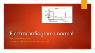 Electrocardiograma normal
DRA. MARIANA GONZALEZ R1
MANUAL DE EKG BÁSICA ANTONI BAYES DE LUNA
 