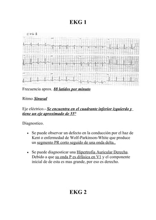 EKG 1




Frecuencia aprox. 88 latidos por minuto

Ritmo Sinusal

Eje eléctrico.- Se encuentra en el cuadrante inferior izquierdo y
tiene un eje aproximado de 55°

Diagnostico.

  •   Se puede observar un defecto en la conducción por el haz de
      Kent o enfermedad de Wolf-Parkinson-White que produce
      un segmento PR corto seguido de una onda delta..

  •   Se puede diagnosticar una Hipertrofia Auricular Derecha.
      Debido a que su onda P es difásica en V1 y el componente
      inicial de de esta es mas grande, por eso es derecho.




                            EKG 2
 