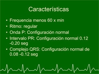 Electrocardiograma y arritmia