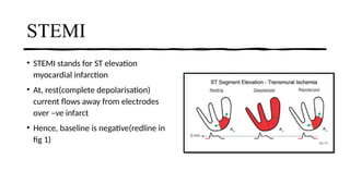 Stemi Button ELECTROCARDIOGRAM CHANGES DURING MYOCARDIAL INFARCTION.pptx
