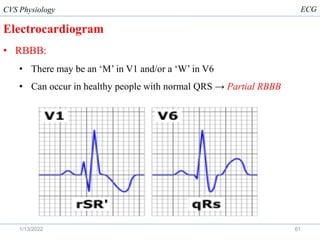 Partial Rbbb Ecg Examples Electrocardiogram (ECG).pdf