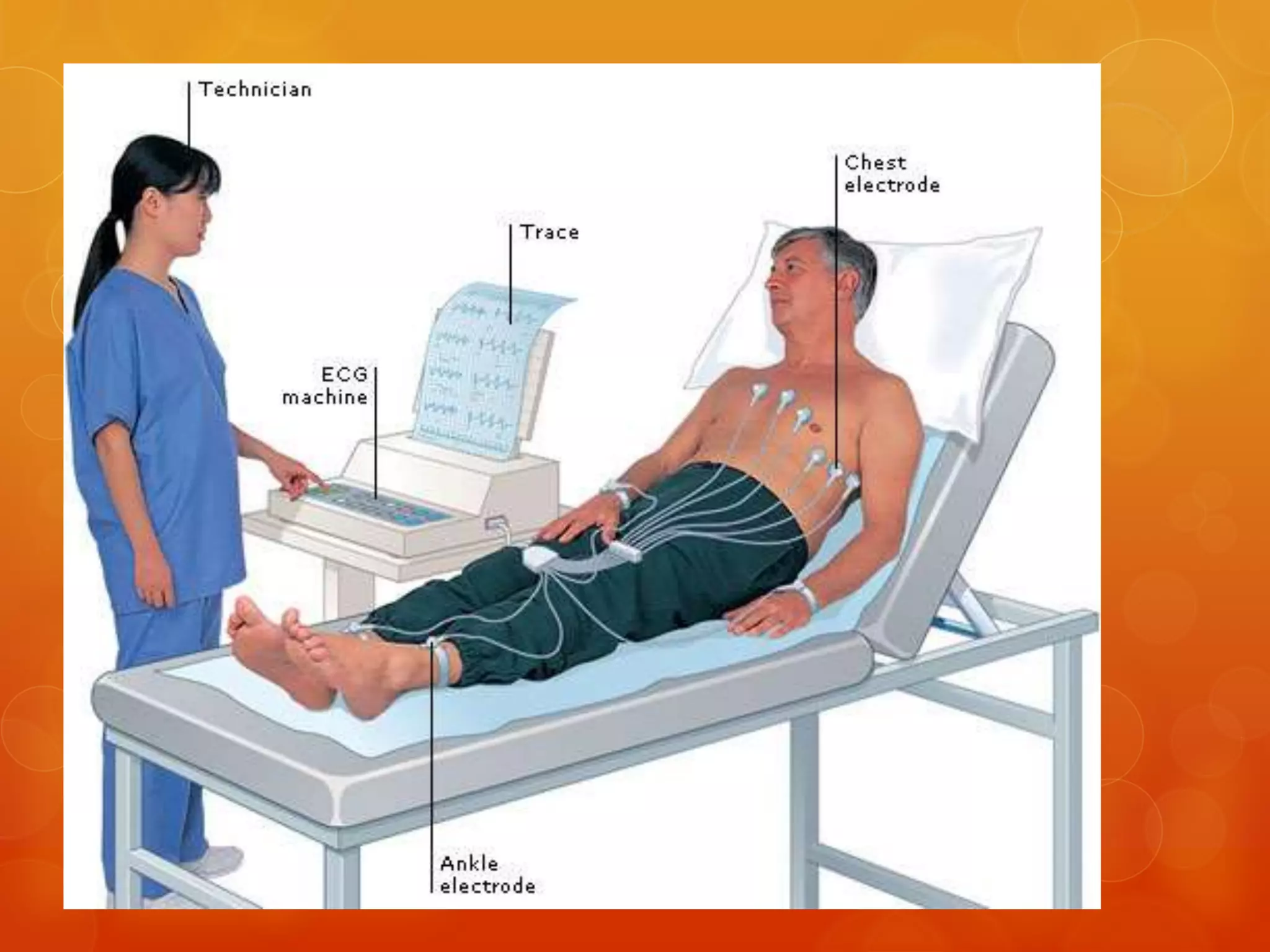 Define Ecg Electrocardiography | PPTX
