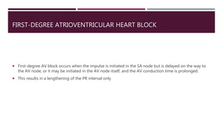 FIRST-DEGREE ATRIOVENTRICULAR HEART BLOCK
 First-degree AV block occurs when the impulse is initiated in the SA node but is delayed on the way to
the AV node; or it may be initiated in the AV node itself, and the AV conduction time is prolonged.
 This results in a lengthening of the PR interval only
 