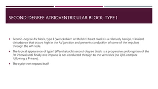 SECOND-DEGREE ATRIOVENTRICULAR BLOCK, TYPE I
 Second-degree AV block, type I (Wenckebach or Mobitz I heart block) is a relatively benign, transient
disturbance that occurs high in the AV junction and prevents conduction of some of the impulses
through the AV node.
 The typical appearance of type I (Wenckebach) second-degree block is a progressive prolongation of the
PR interval until finally one impulse is not conducted through to the ventricles (no QRS complex
following a P wave).
 The cycle then repeats itself
 