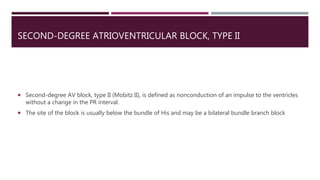 SECOND-DEGREE ATRIOVENTRICULAR BLOCK, TYPE II
 Second-degree AV block, type II (Mobitz II), is defined as nonconduction of an impulse to the ventricles
without a change in the PR interval.
 The site of the block is usually below the bundle of His and may be a bilateral bundle branch block
 