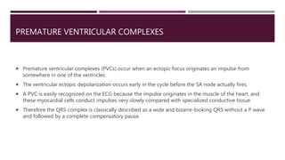 PREMATURE VENTRICULAR COMPLEXES
 Premature ventricular complexes (PVCs) occur when an ectopic focus originates an impulse from
somewhere in one of the ventricles.
 The ventricular ectopic depolarization occurs early in the cycle before the SA node actually fires.
 A PVC is easily recognized on the ECG because the impulse originates in the muscle of the heart, and
these myocardial cells conduct impulses very slowly compared with specialized conductive tissue.
 Therefore the QRS complex is classically described as a wide and bizarre-looking QRS without a P wave
and followed by a complete compensatory pause.
 