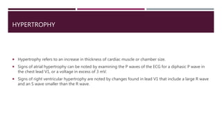 HYPERTROPHY
 Hypertrophy refers to an increase in thickness of cardiac muscle or chamber size.
 Signs of atrial hypertrophy can be noted by examining the P waves of the ECG for a diphasic P wave in
the chest lead V1, or a voltage in excess of 3 mV.
 Signs of right ventricular hypertrophy are noted by changes found in lead V1 that include a large R wave
and an S wave smaller than the R wave.
 