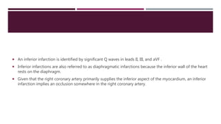  An inferior infarction is identified by significant Q waves in leads II, III, and aVF .
 Inferior infarctions are also referred to as diaphragmatic infarctions because the inferior wall of the heart
rests on the diaphragm.
 Given that the right coronary artery primarily supplies the inferior aspect of the myocardium, an inferior
infarction implies an occlusion somewhere in the right coronary artery.
 