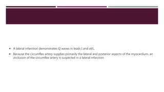  A lateral infarction demonstrates Q waves in leads I and aVL.
 Because the circumflex artery supplies primarily the lateral and posterior aspects of the myocardium, an
occlusion of the circumflex artery is suspected in a lateral infarction.
 