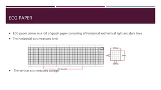 ECG PAPER
 ECG paper comes in a roll of graph paper consisting of horizontal and vertical light and dark lines.
 The horizontal axis measures time
 The vertical axis measures voltage.
 