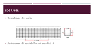 ECG PAPER
 One small square = 0.04 seconds
 One large square = 0.2 seconds Or [One small square(0.04)] x 5
 