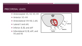 PRECORDIAL LEADS
 Anteroseptal: V1, V2, V3, V4
 Anterior: V1–V4
 Anterolateral: V4–V6, I, aVL
 Lateral: I and aVL
 Inferior: II, III, and aVF
 Inferolateral: II, III, aVF, and
V5 and V6
 