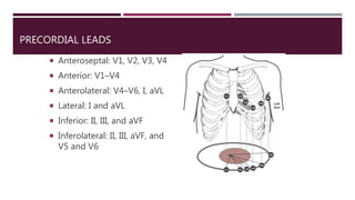 PRECORDIAL LEADS
 Anteroseptal: V1, V2, V3, V4
 Anterior: V1–V4
 Anterolateral: V4–V6, I, aVL
 Lateral: I and aVL
 Inferior: II, III, and aVF
 Inferolateral: II, III, aVF, and
V5 and V6
 