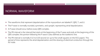NORMAL WAVEFORM
 The waveforms that represent depolarization of the myocardium are labeled P, QRS, T, and U.
 The P wave is normally rounded, symmetric, and upright, representing atrial depolarization.
 A P wave should occur before every QRS complex.
 The PR interval is the interval that starts at the beginning of the P wave and ends at the beginning of the
QRS complex; the portion following the P wave is also defined as the isoelectric line.
 The PR interval is normally 0.12 to 0.20 second (or up to five small squares on the ECG paper). This
period of time represents the atrial depolarization and the slowing of electrical conduction through the
AV node.
 