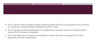  The ST segment follows the QRS complex, beginning where the ECG tracing transforms from a thin line
to a thicker line and terminating at the beginning of the T wave.
 The ST segment should be represented as an isoelectric line along the same line (if measured with a
ruler) as the PR interval or the baseline.
 The T wave follows the ST segment and should be rounded, symmetric, and upright. The T wave
represents ventricular repolarization.
 