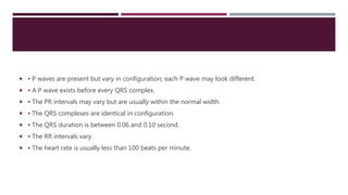  ▪ P waves are present but vary in configuration; each P wave may look different.
 ▪ A P wave exists before every QRS complex.
 ▪ The PR intervals may vary but are usually within the normal width.
 ▪ The QRS complexes are identical in configuration.
 ▪ The QRS duration is between 0.06 and 0.10 second.
 ▪ The RR intervals vary.
 ▪ The heart rate is usually less than 100 beats per minute.
 