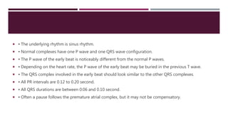  ▪ The underlying rhythm is sinus rhythm.
 ▪ Normal complexes have one P wave and one QRS wave configuration.
 ▪ The P wave of the early beat is noticeably different from the normal P waves.
 ▪ Depending on the heart rate, the P wave of the early beat may be buried in the previous T wave.
 ▪ The QRS complex involved in the early beat should look similar to the other QRS complexes.
 ▪ All PR intervals are 0.12 to 0.20 second.
 ▪ All QRS durations are between 0.06 and 0.10 second.
 ▪ Often a pause follows the premature atrial complex, but it may not be compensatory.
 