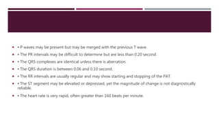  ▪ P waves may be present but may be merged with the previous T wave.
 ▪ The PR intervals may be difficult to determine but are less than 0.20 second.
 ▪ The QRS complexes are identical unless there is aberration.
 ▪ The QRS duration is between 0.06 and 0.10 second.
 ▪ The RR intervals are usually regular and may show starting and stopping of the PAT.
 ▪ The ST segment may be elevated or depressed, yet the magnitude of change is not diagnostically
reliable.
 ▪ The heart rate is very rapid, often greater than 160 beats per minute.
 