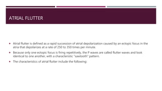 ATRIAL FLUTTER
 Atrial flutter is defined as a rapid succession of atrial depolarization caused by an ectopic focus in the
atria that depolarizes at a rate of 250 to 350 times per minute.
 Because only one ectopic focus is firing repetitively, the P waves are called flutter waves and look
identical to one another, with a characteristic “sawtooth” pattern.
 The characteristics of atrial flutter include the following:
 