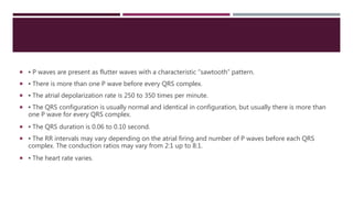  ▪ P waves are present as flutter waves with a characteristic “sawtooth” pattern.
 ▪ There is more than one P wave before every QRS complex.
 ▪ The atrial depolarization rate is 250 to 350 times per minute.
 ▪ The QRS configuration is usually normal and identical in configuration, but usually there is more than
one P wave for every QRS complex.
 ▪ The QRS duration is 0.06 to 0.10 second.
 ▪ The RR intervals may vary depending on the atrial firing and number of P waves before each QRS
complex. The conduction ratios may vary from 2:1 up to 8:1.
 ▪ The heart rate varies.
 