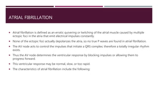 ATRIAL FIBRILLATION
 Atrial fibrillation is defined as an erratic quivering or twitching of the atrial muscle caused by multiple
ectopic foci in the atria that emit electrical impulses constantly.
 None of the ectopic foci actually depolarizes the atria, so no true P waves are found in atrial fibrillation.
 The AV node acts to control the impulses that initiate a QRS complex; therefore a totally irregular rhythm
exists.
 Thus the AV node determines the ventricular response by blocking impulses or allowing them to
progress forward.
 This ventricular response may be normal, slow, or too rapid.
 The characteristics of atrial fibrillation include the following:
 