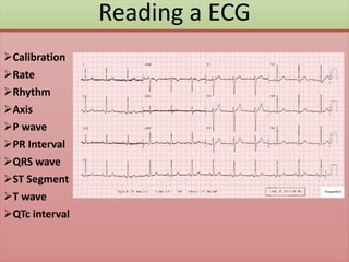 Reading a ECG
Calibration
Rate
Rhythm
Axis
P wave
PR Interval
QRS wave
ST Segment
T wave
QTc interval
 