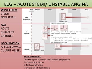 ECG – ACUTE STEMI/ UNSTABLE ANGINA
WAVE FORM
STEMI
NON STEMI
AGE
ACUTE
SUBACUTE
CHRONIC
LOCALIZATION
AFFECTED WALL
CULPRIT VESSEL
OTHER FINDINGS
Pathological Q waves, Poor R wave progression
 Conduction Blocks
Tachyarrhythmias
Unexplained Heart Failure
 