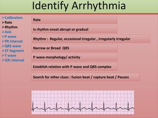 Identify Arrhythmia
Calibration
Rate
Rhythm
Axis
P wave
PR Interval
QRS wave
ST Segment
T wave
QTc interval
Rate
Rhythm : Regular, occasional irregular , irregularly irregular
Narrow or Broad QRS
P wave morphology/ activity
Establish relation with P wave and QRS complex
Search for other clues : fusion beat / capture beat / Pauses
Is rhythm onset abrupt or gradual
 