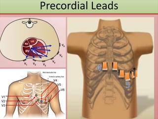 Precordial Leads
 